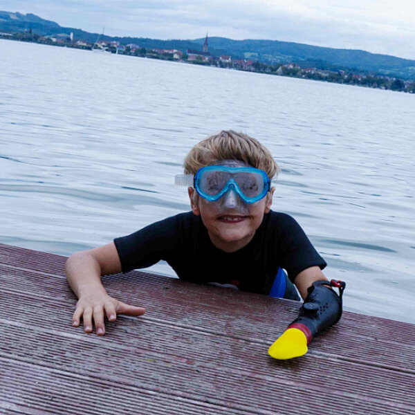 Explorer System-Kinder-Armprothesen-FiNiFuchs